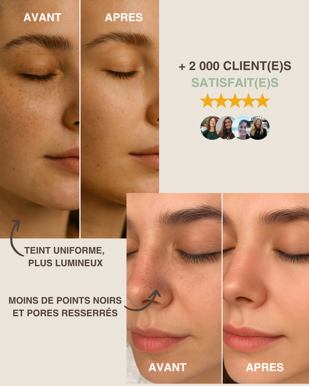 Skin Scrubber – L’Allié Peau Zéro Défaut