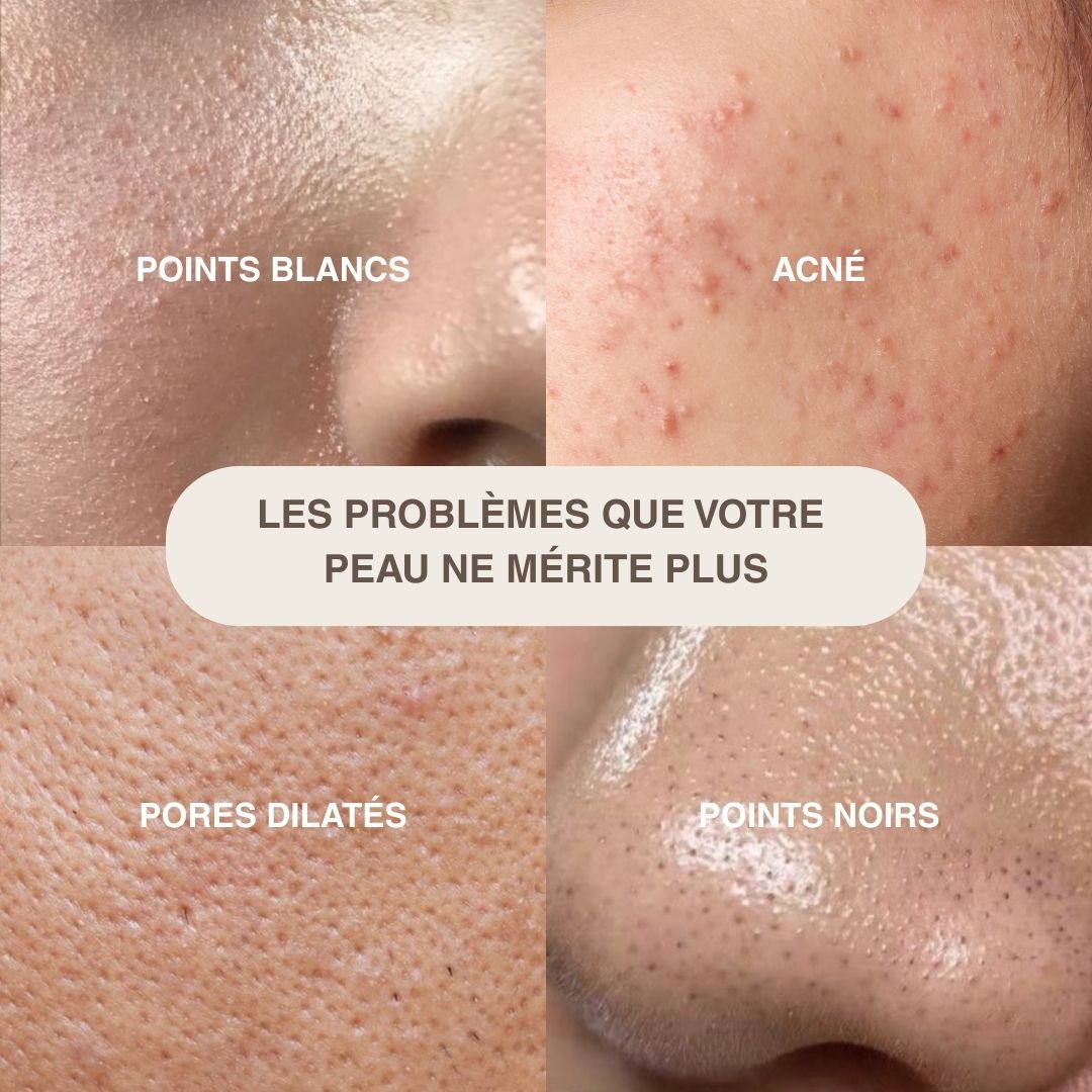 Épurateur de peau ultrasonique - 4 modes