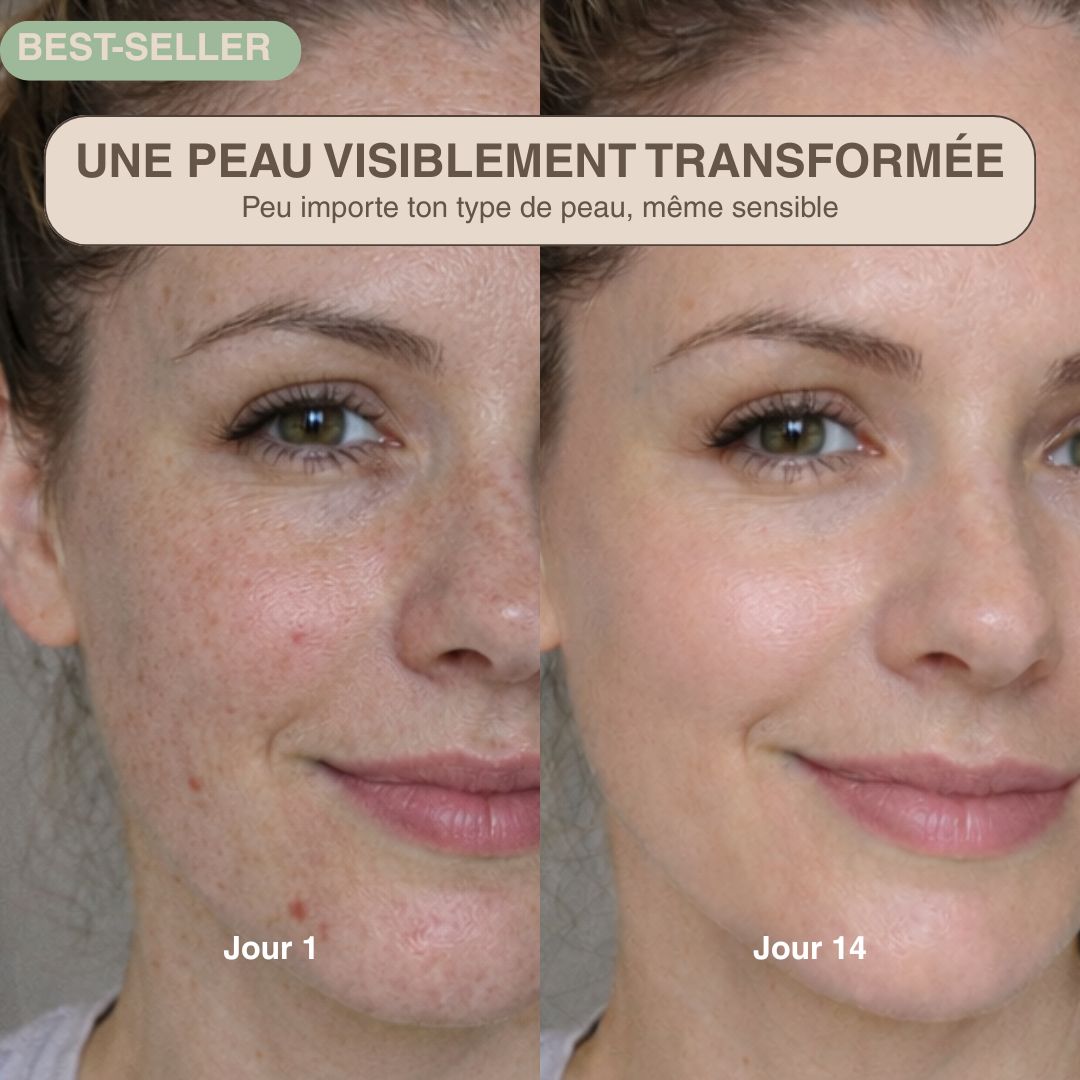 Épurateur de peau ultrasonique - 4 modes