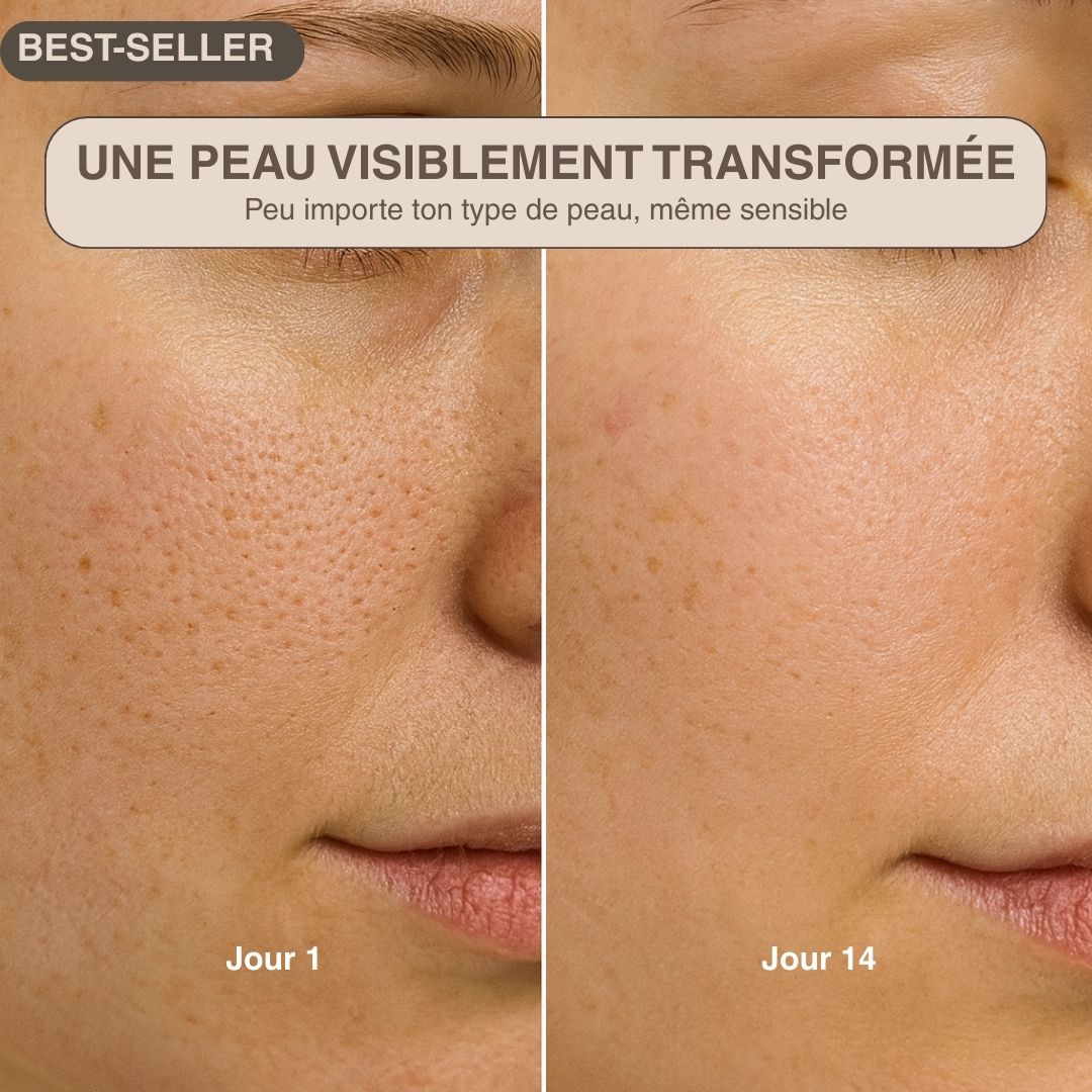 Épurateur de peau ultrasonique - 4 modes