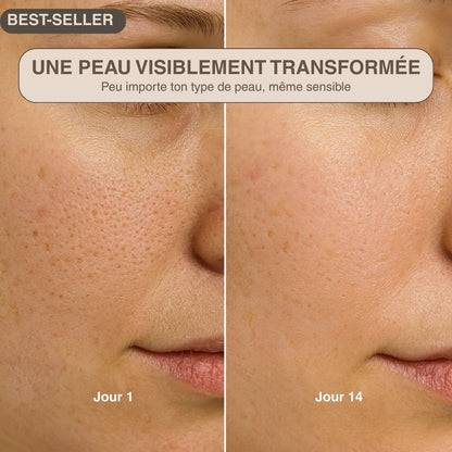 Épurateur de peau ultrasonique - 4 modes