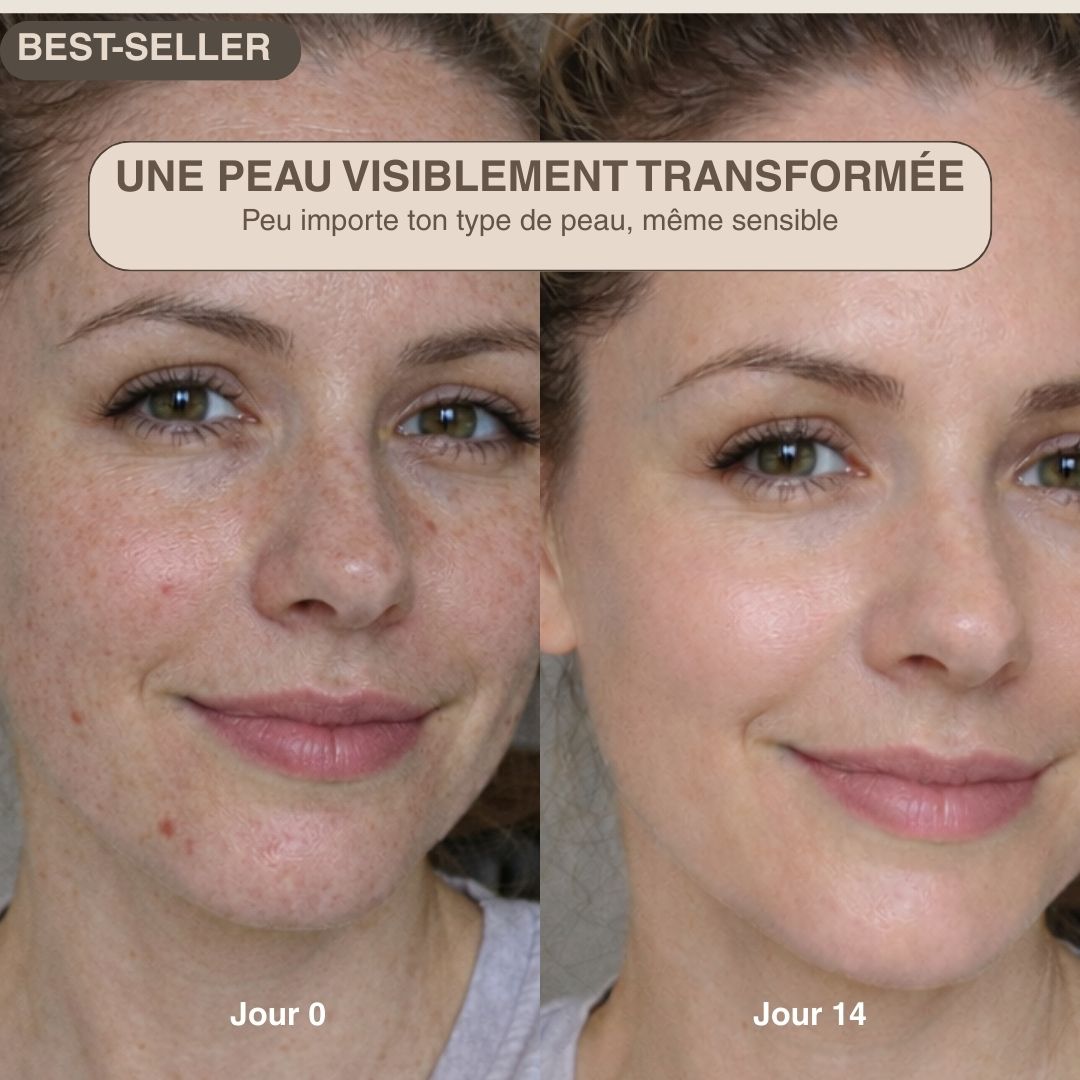 Épurateur de peau ultrasonique - 4 modes