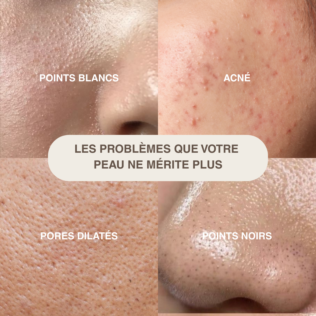 Épurateur de peau ultrasonique - 4 modes