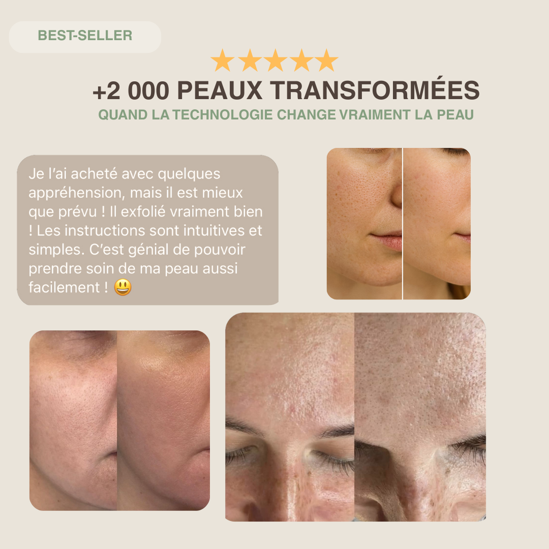 Épurateur de peau ultrasonique - 4 modes