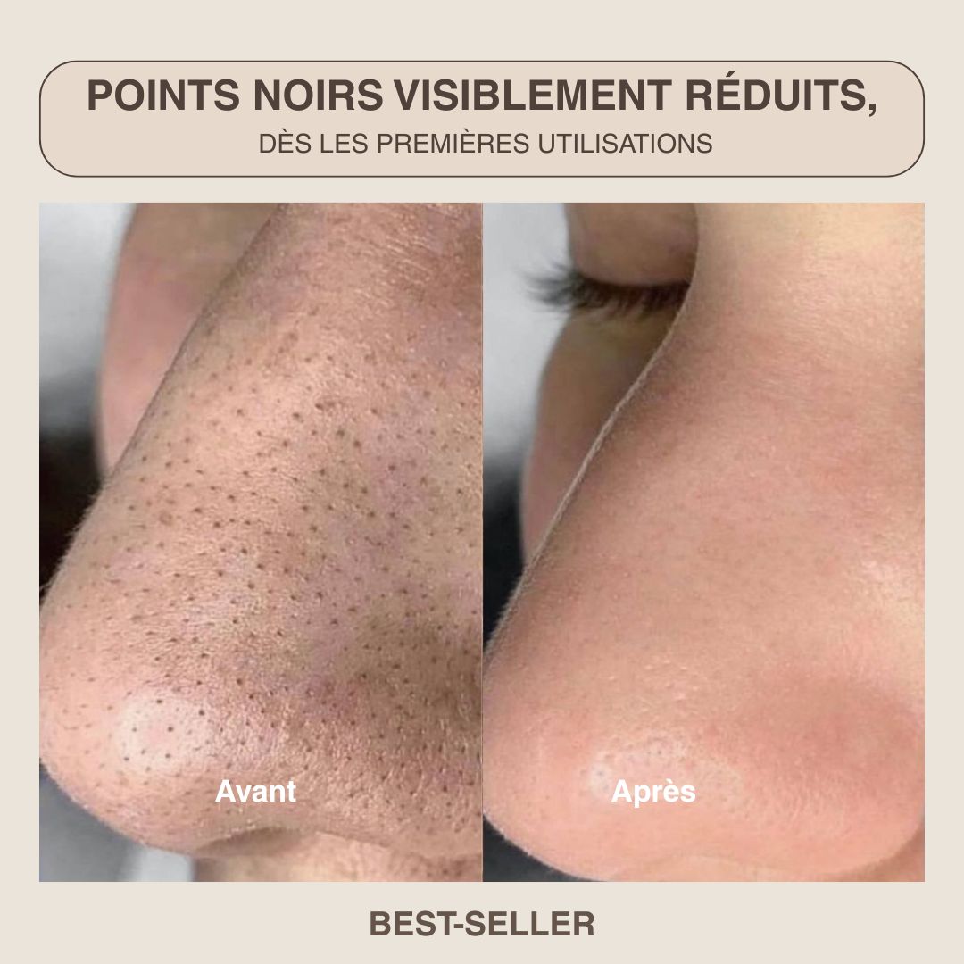 Épurateur de peau ultrasonique - 4 modes